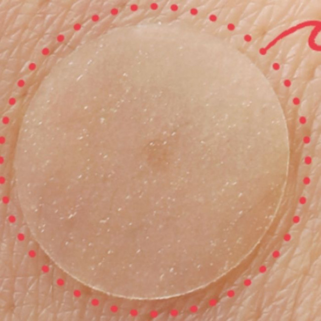 Патчи от прыщей Elizavecca Witch Piggy Hell Pore Blemish Spot Patch ...