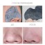 Купить The Face Shop Jeju Volcanic Lava Volcanic Ash Nose Strips