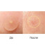 Эффект Elizavecca Witch Piggy Hell Pore Blemish Spot Patch